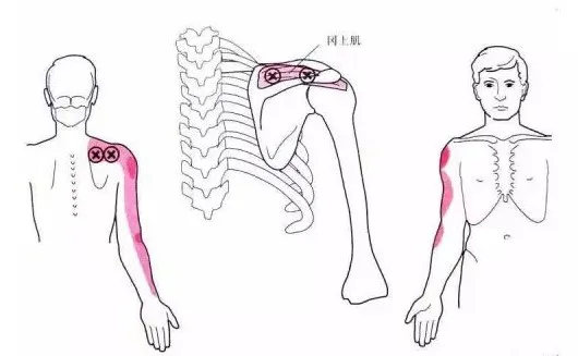怎么评估病人肌力“肩 髋 膝 踝” 4大关节体格检查,干货速取!_新闻资讯_第5张_活检穿刺产品网 怎么评估病人肌力“肩 髋 膝 踝” 4大关节体格检查,干货速取!_https://www.jmylbn.com_新闻资讯_第5张