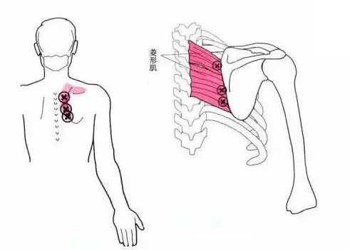 怎么评估病人肌力“肩 髋 膝 踝” 4大关节体格检查，干货速取！_https://www.jmylbn.com_新闻资讯_第9张
