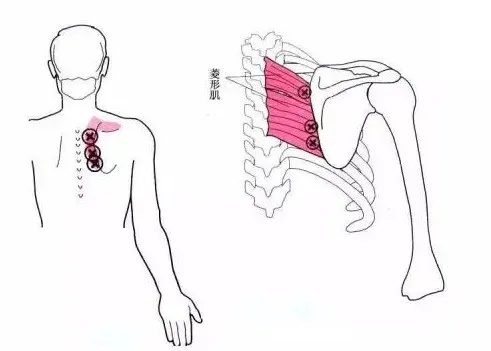 怎么评估病人肌力“肩 髋 膝 踝” 4大关节体格检查,干货速取!_新闻资讯_第9张_活检穿刺产品网 怎么评估病人肌力“肩 髋 膝 踝” 4大关节体格检查,干货速取!_https://www.jmylbn.com_新闻资讯_第9张