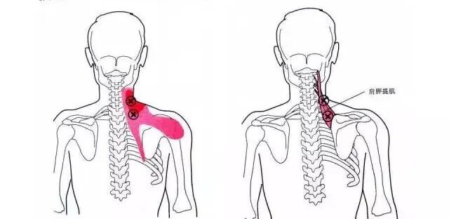 怎么评估病人肌力“肩 髋 膝 踝” 4大关节体格检查，干货速取！_https://www.jmylbn.com_新闻资讯_第4张