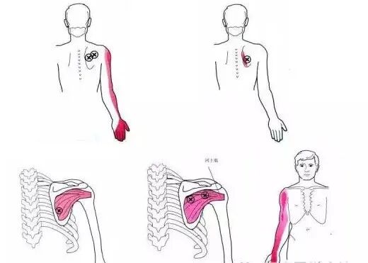 怎么评估病人肌力“肩 髋 膝 踝” 4大关节体格检查，干货速取！_https://www.jmylbn.com_新闻资讯_第6张