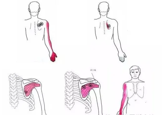 怎么评估病人肌力“肩 髋 膝 踝” 4大关节体格检查,干货速取!_新闻资讯_第6张_活检穿刺产品网 怎么评估病人肌力“肩 髋 膝 踝” 4大关节体格检查,干货速取!_https://www.jmylbn.com_新闻资讯_第6张