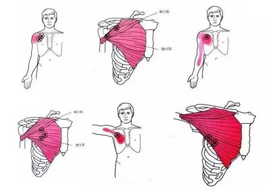 怎么评估病人肌力“肩 髋 膝 踝” 4大关节体格检查,干货速取!_新闻资讯_第10张_活检穿刺产品网 怎么评估病人肌力“肩 髋 膝 踝” 4大关节体格检查,干货速取!_https://www.jmylbn.com_新闻资讯_第10张
