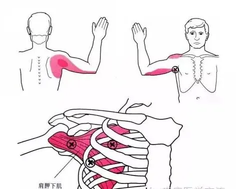 怎么评估病人肌力“肩 髋 膝 踝” 4大关节体格检查,干货速取!_新闻资讯_第8张_活检穿刺产品网 怎么评估病人肌力“肩 髋 膝 踝” 4大关节体格检查,干货速取!_https://www.jmylbn.com_新闻资讯_第8张