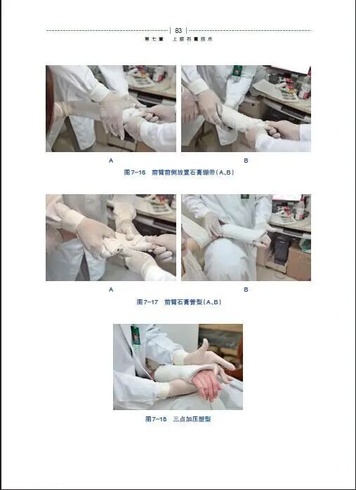 绷带石膏怎么拆除骨科石膏绷带外固定技术的操作要领，大量彩页直观明了！_https://www.jmylbn.com_新闻资讯_第9张