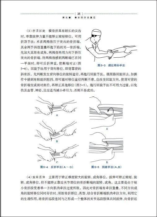 绷带石膏怎么拆除骨科石膏绷带外固定技术的操作要领，大量彩页直观明了！_https://www.jmylbn.com_新闻资讯_第6张