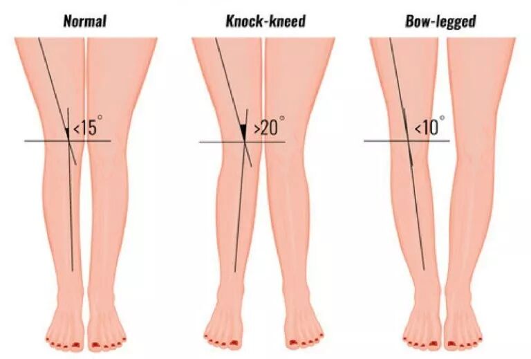 怎么评估病人肌力“肩 髋 膝 踝” 4大关节体格检查，干货速取！_https://www.jmylbn.com_新闻资讯_第42张