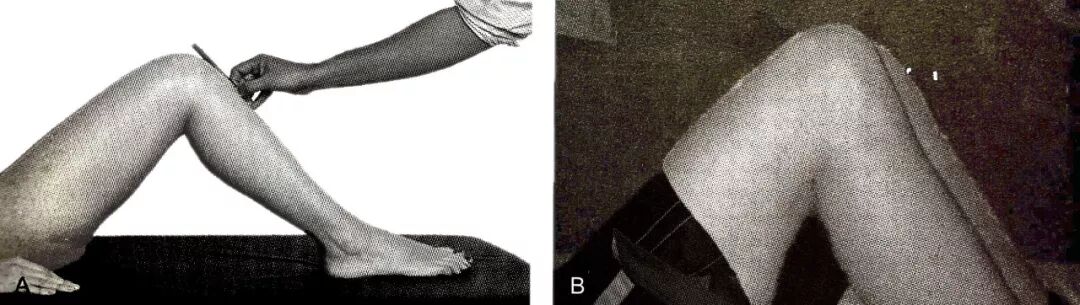 怎么评估病人肌力“肩 髋 膝 踝” 4大关节体格检查，干货速取！_https://www.jmylbn.com_新闻资讯_第43张