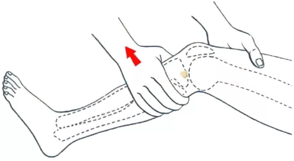 怎么评估病人肌力“肩 髋 膝 踝” 4大关节体格检查，干货速取！_https://www.jmylbn.com_新闻资讯_第45张