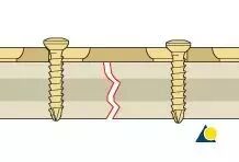 生物钉是什么材料骨折常用内固定材料&选择原则，超详细！_https://www.jmylbn.com_新闻资讯_第6张