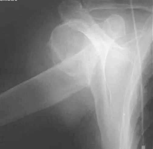 疼痛科怎么理疗疼痛科医生、康复理疗科医生、针刀针灸医生应掌握的常见骨科疾病X光片_https://www.jmylbn.com_新闻资讯_第7张