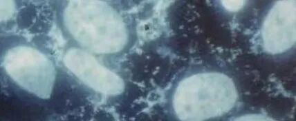 細胞被支原體污染怎么辦？