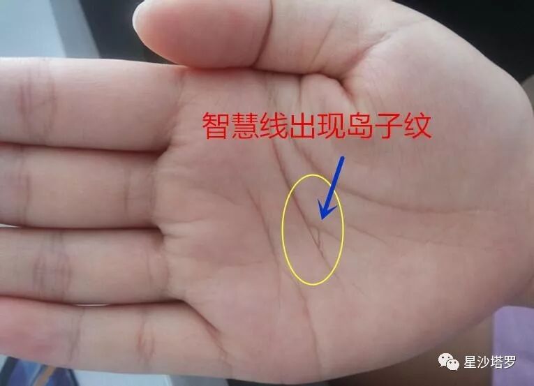 手相 这个符号的出现 一定要特别注意 喃语情话 微信公众号文章阅读 Wemp