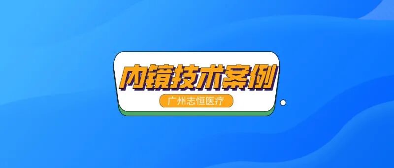 内窥镜怎么清洗内镜清洗机操作流程_https://www.jmylbn.com_新闻资讯_第7张