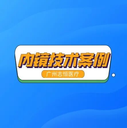 为什么要校正血酮仪雅培血糖血酮仪 屏幕报错E6处理方法_https://www.jmylbn.com_新闻资讯_第12张