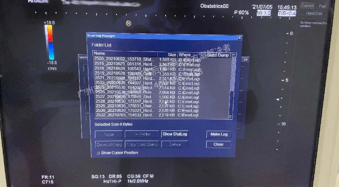 日立图腾怎么样超声案例：日立图腾血流模式报错_https://www.jmylbn.com_新闻资讯_第9张