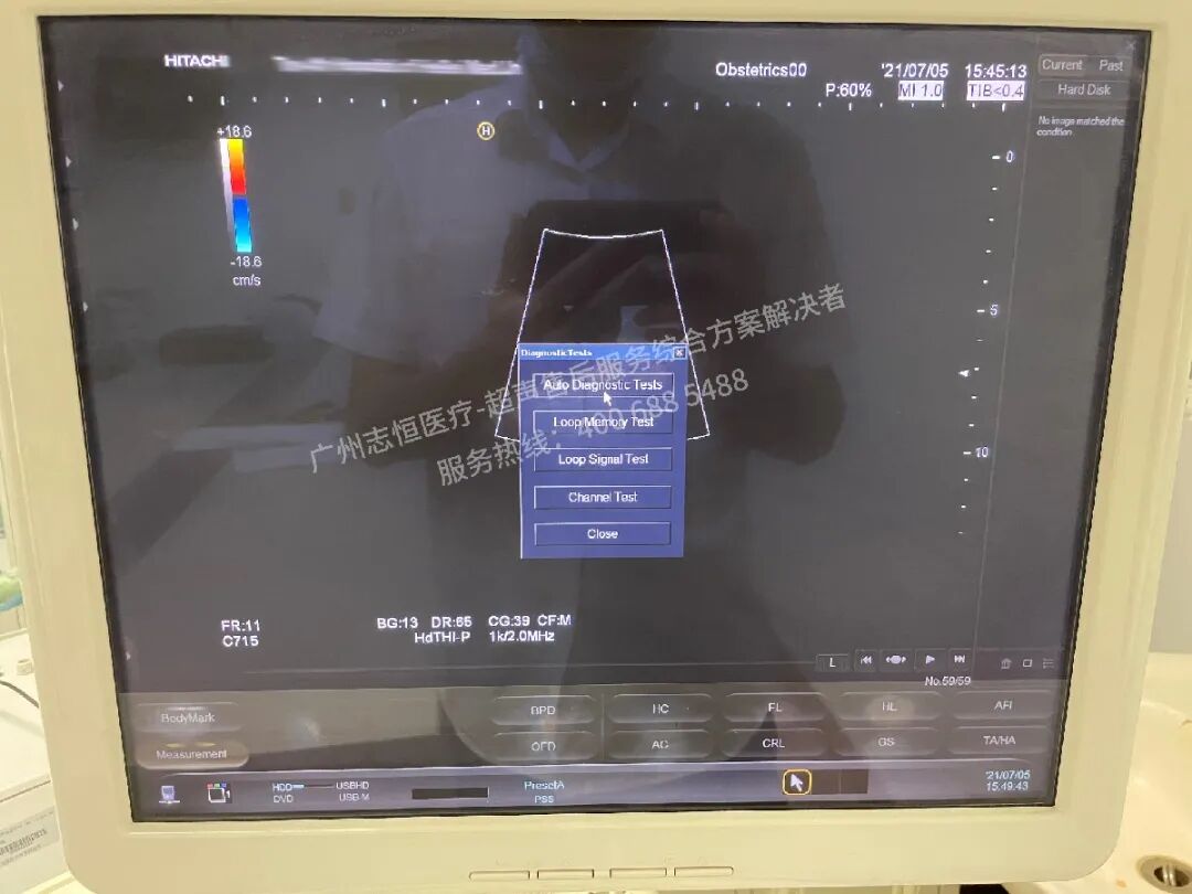 日立图腾怎么样超声案例：日立图腾血流模式报错_https://www.jmylbn.com_新闻资讯_第6张