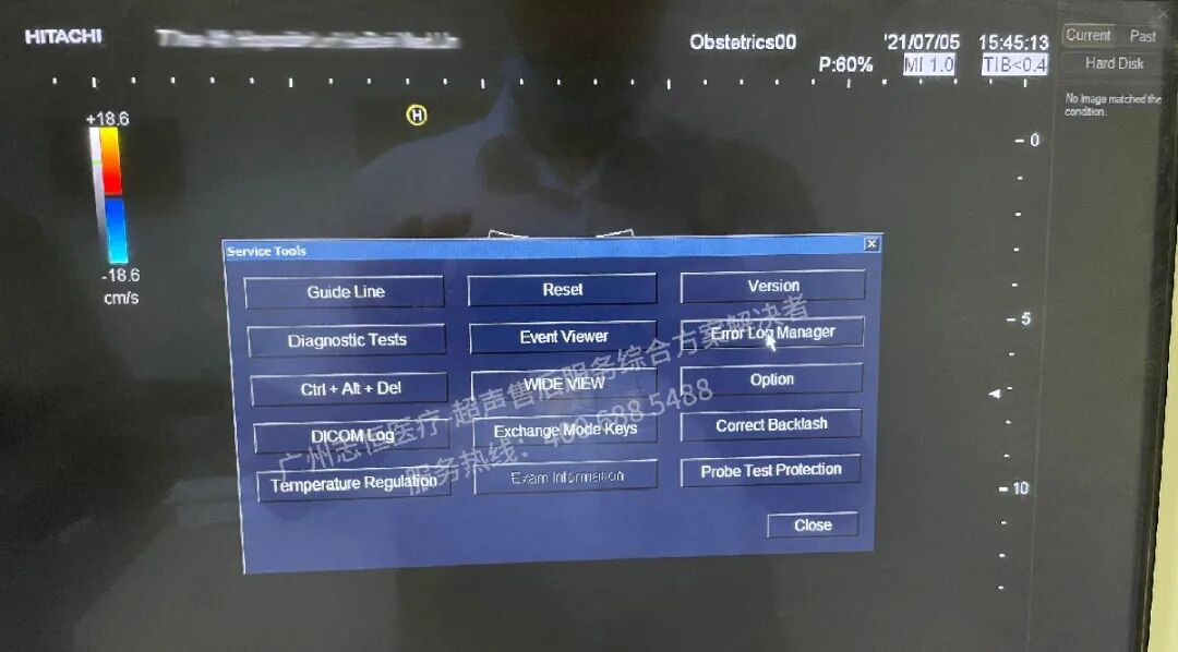 日立图腾怎么样超声案例：日立图腾血流模式报错_https://www.jmylbn.com_新闻资讯_第8张