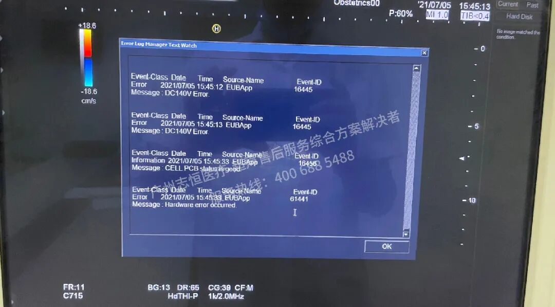 日立图腾怎么样超声案例：日立图腾血流模式报错_https://www.jmylbn.com_新闻资讯_第11张