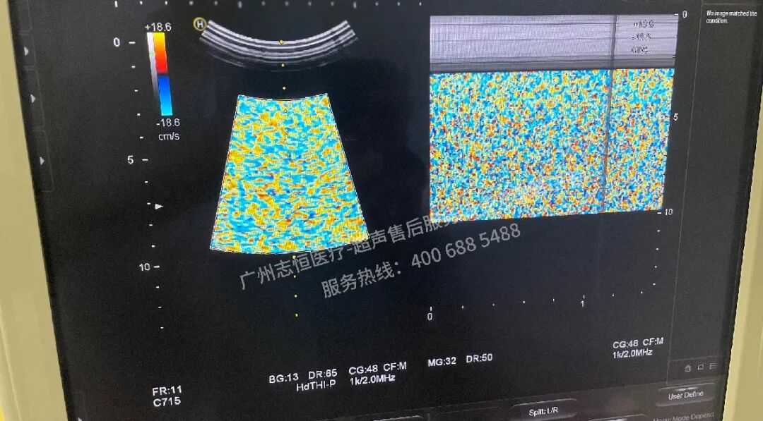 日立图腾怎么样超声案例：日立图腾血流模式报错_https://www.jmylbn.com_新闻资讯_第19张