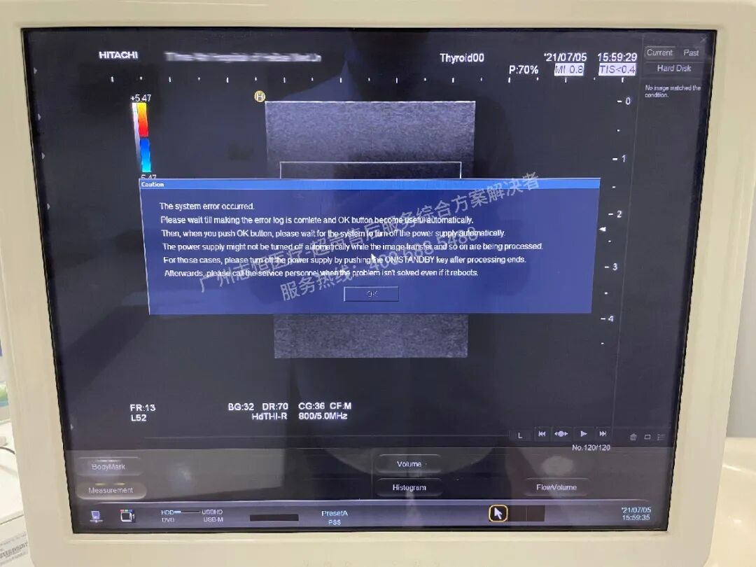 日立图腾怎么样超声案例：日立图腾血流模式报错_https://www.jmylbn.com_新闻资讯_第3张
