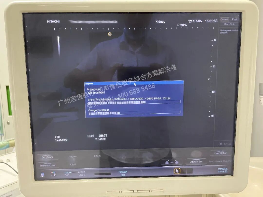 日立图腾怎么样超声案例：日立图腾血流模式报错_https://www.jmylbn.com_新闻资讯_第7张