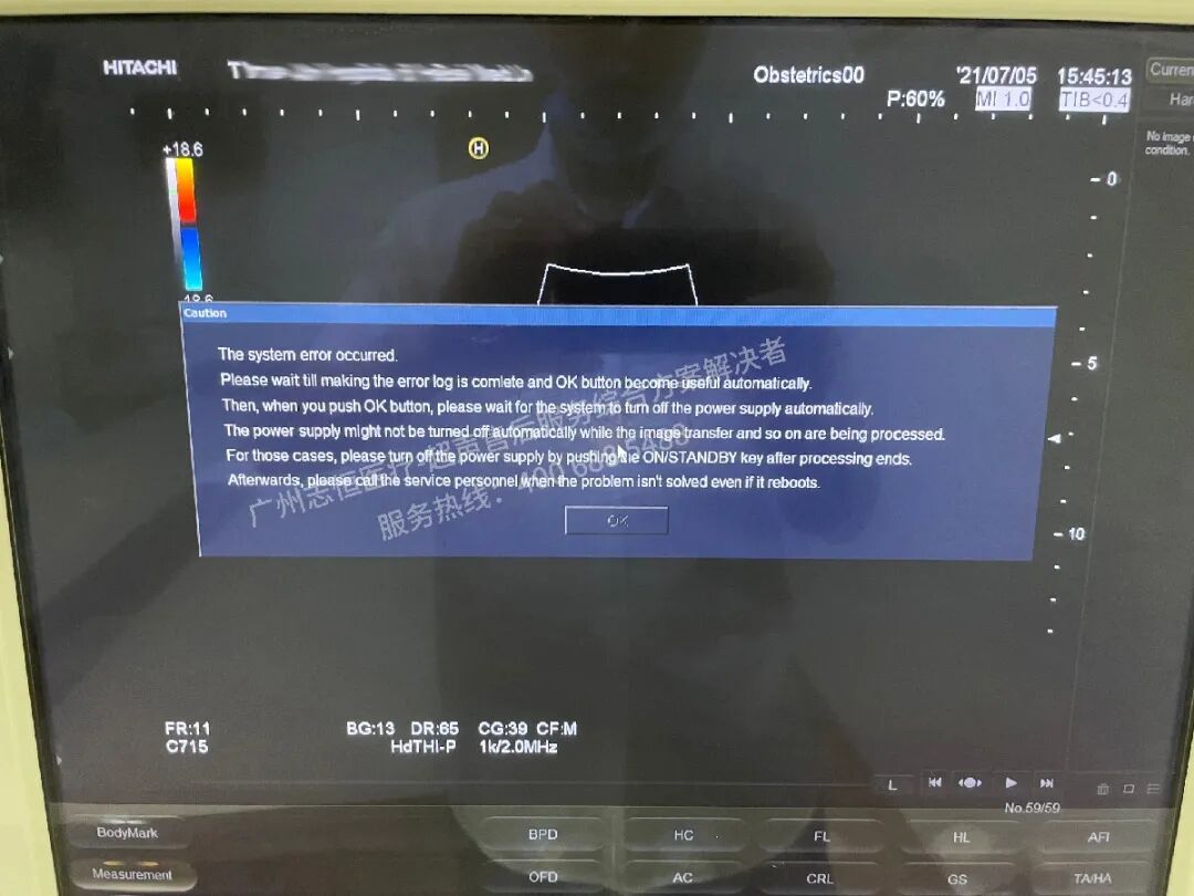 日立图腾怎么样超声案例：日立图腾血流模式报错_https://www.jmylbn.com_新闻资讯_第2张
