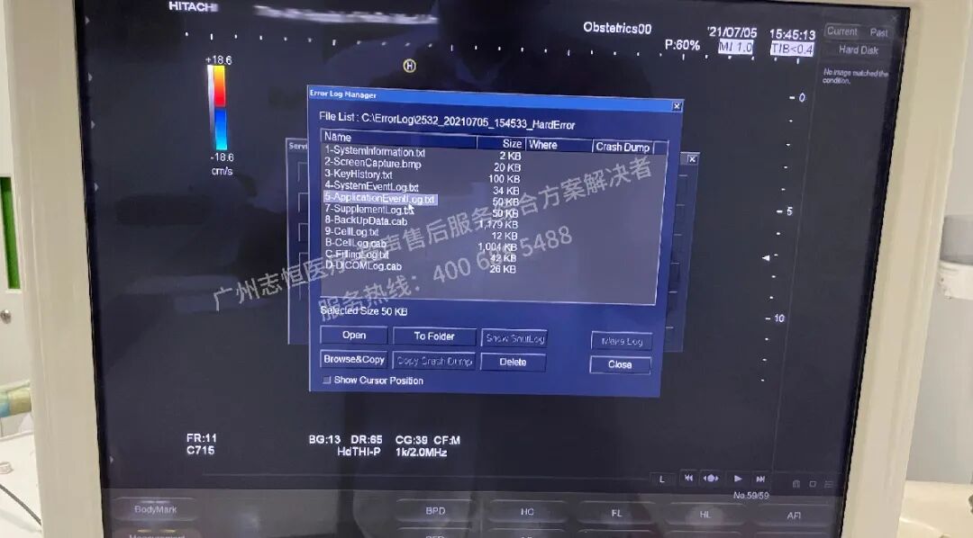 日立图腾怎么样超声案例：日立图腾血流模式报错_https://www.jmylbn.com_新闻资讯_第10张