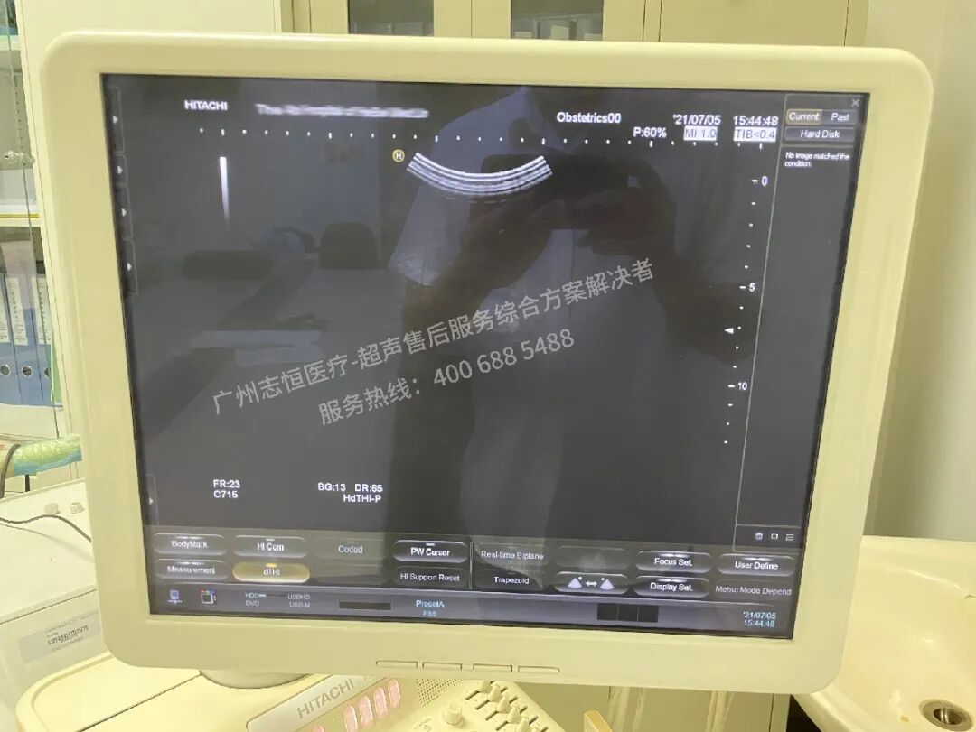 日立图腾怎么样超声案例：日立图腾血流模式报错_https://www.jmylbn.com_新闻资讯_第5张