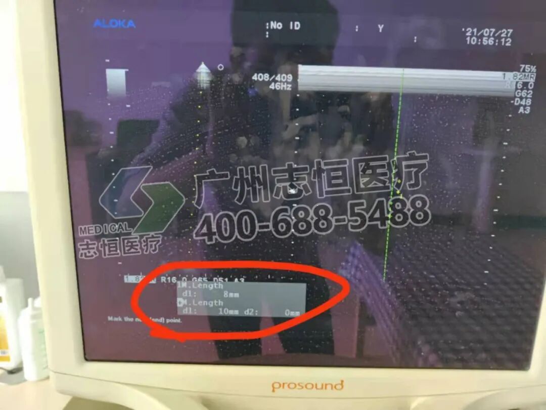 aloka超声怎么样超声案例：Aloka α7 开机无显示_https://www.jmylbn.com_新闻资讯_第12张