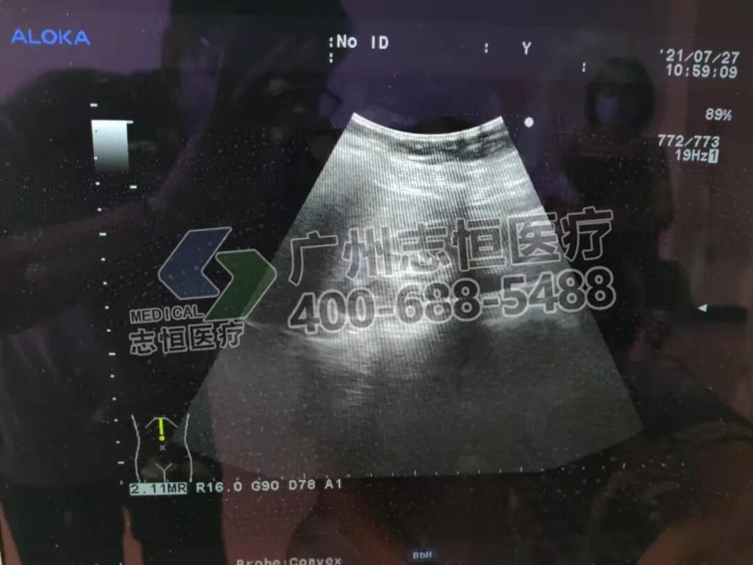 aloka超声怎么样超声案例：Aloka α7 开机无显示_https://www.jmylbn.com_新闻资讯_第11张
