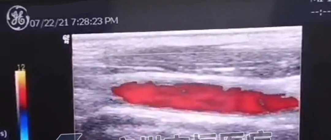 logiq e怎么读超声案例：GE LOGIQ P9 开机无显示_https://www.jmylbn.com_新闻资讯_第18张