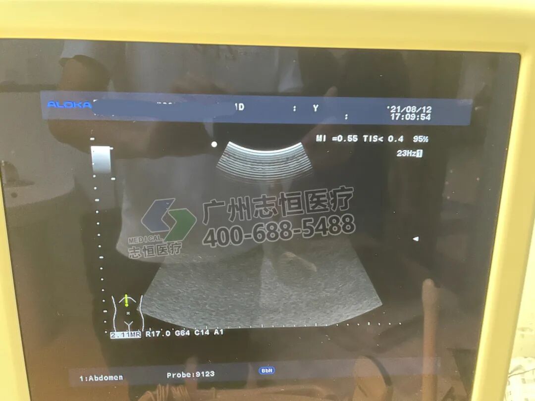 aloka超声怎么样超声维修：ALOKA α6 图像亮道故障_https://www.jmylbn.com_新闻资讯_第12张