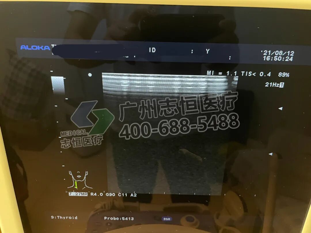aloka超声怎么样超声维修：ALOKA α6 图像亮道故障_https://www.jmylbn.com_新闻资讯_第5张