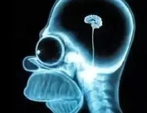 1956年发生的诡异杀人事件，凶手在X光下竟然没有大脑！