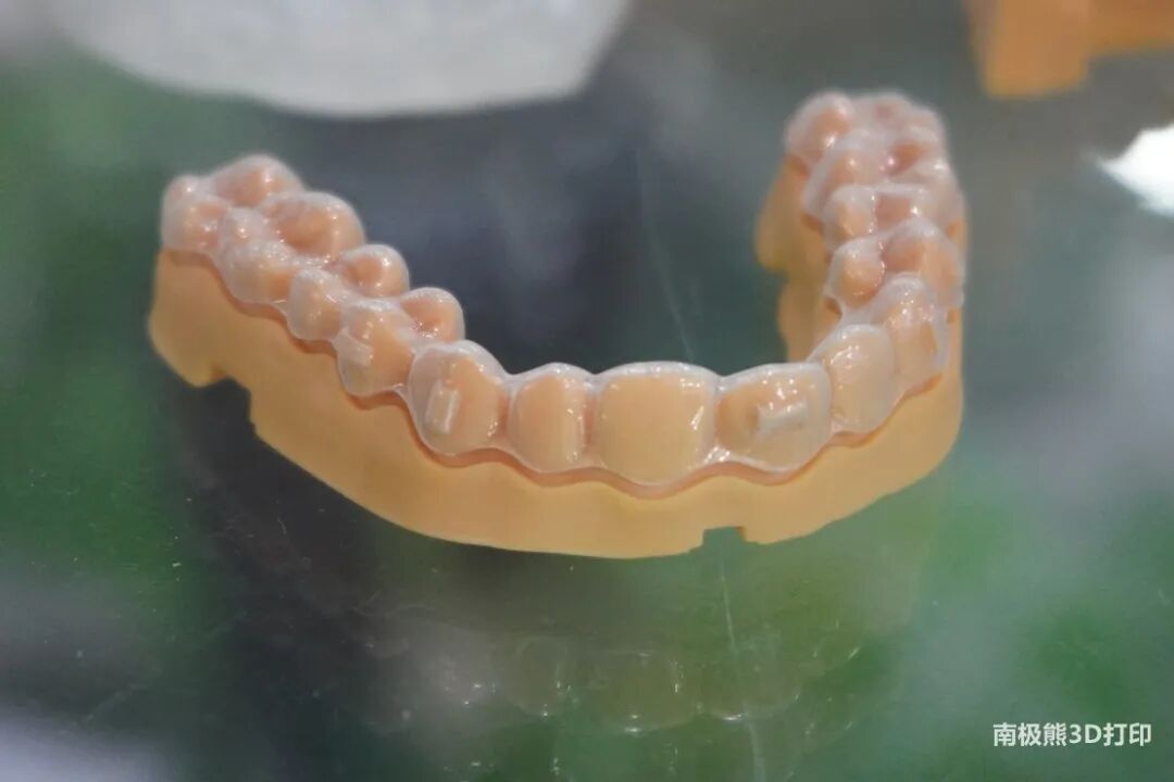 專訪國產DLP光固化黑馬：3D打印導板成本只有幾十元，卻能撬動上萬元齒科業務的圖4
