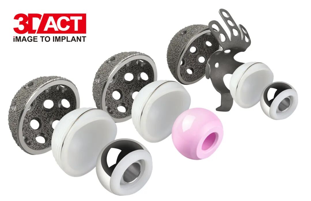 爱康医疗2020年营收10.35亿元，骨科3D打印植入物产品达1.2亿元的图6