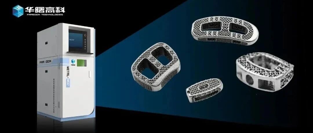 药监局批准国内首款激光金属3D打印骨科植入物“多孔型椎间融合器”上市，湖南华翔与华曙高科联合开发