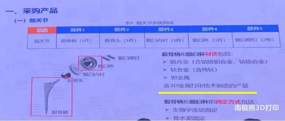 国家集采：金属3D打印骨科应用有望爆发的图2