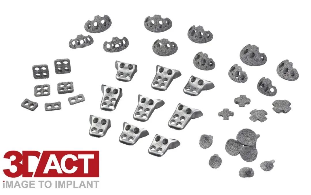 国家集采：金属3D打印骨科应用有望爆发的图5
