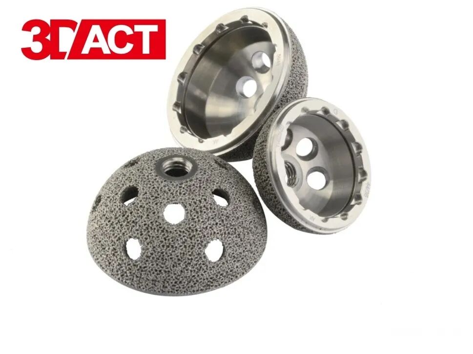 国家集采：金属3D打印骨科应用有望爆发的图3