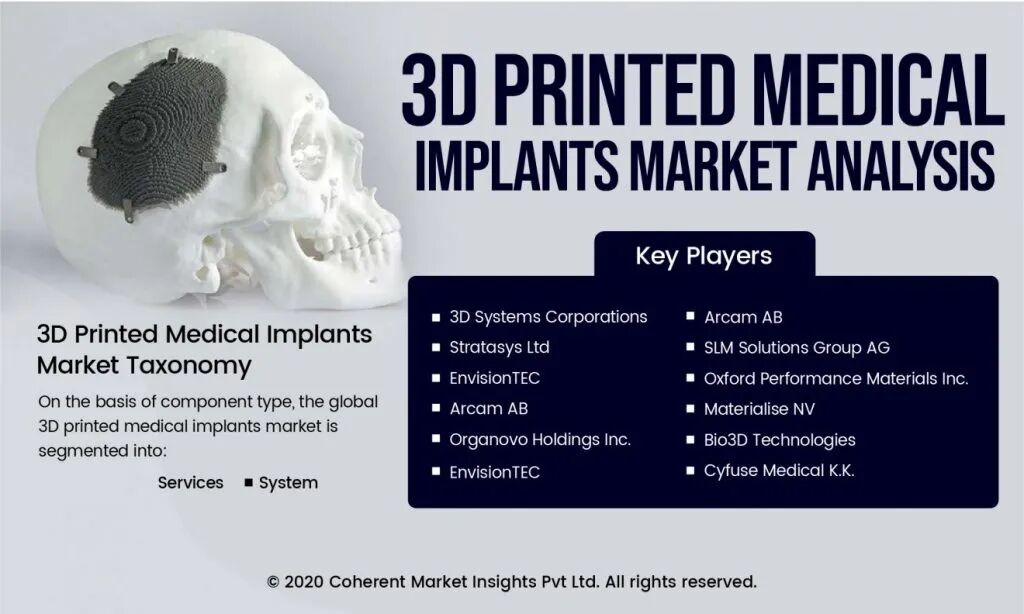 3D打印骨盆获得FDA批准，Onkos Surgical 已允许用于临床重建治疗的图4