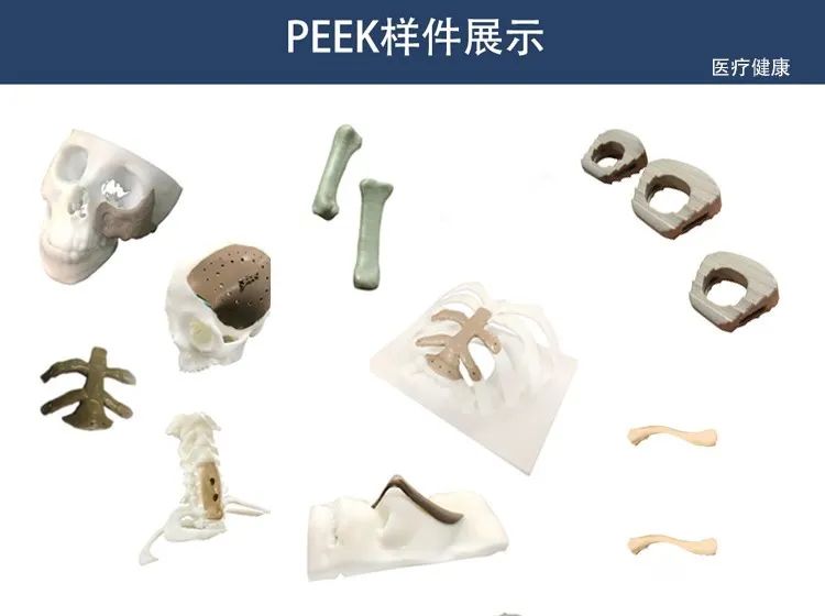 PEEK 3D列印技術在醫療領域的應用研究 科技 第1張