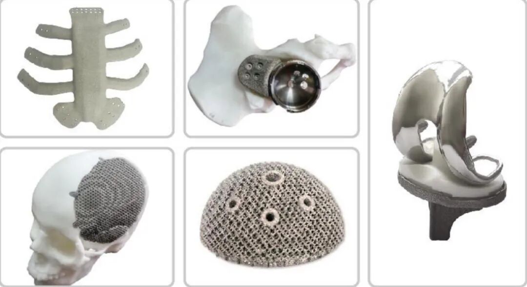 每日一品：国产骨科电子束金属3D打印机，智束科技QbeamMed200的图3