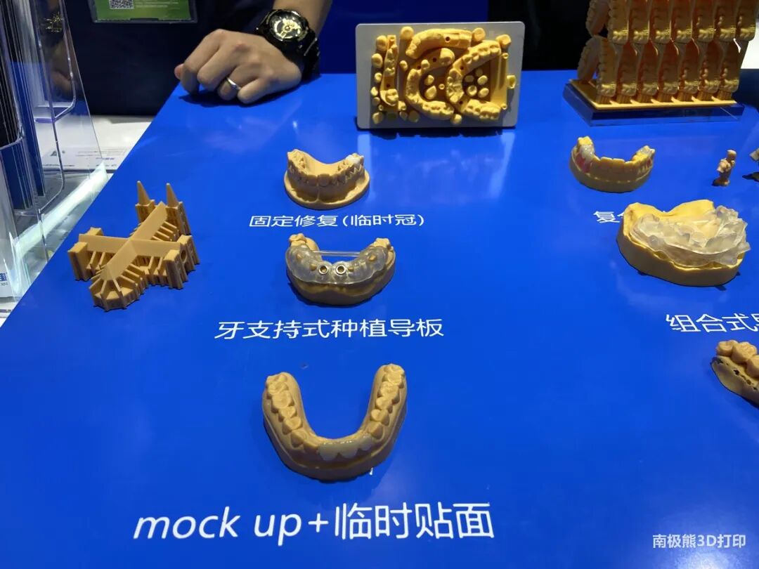 齿科3D打印百花齐放，已成数字化口腔工艺重要环节的图6