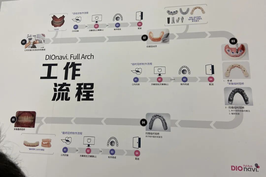 齿科3D打印百花齐放，已成数字化口腔工艺重要环节的图1