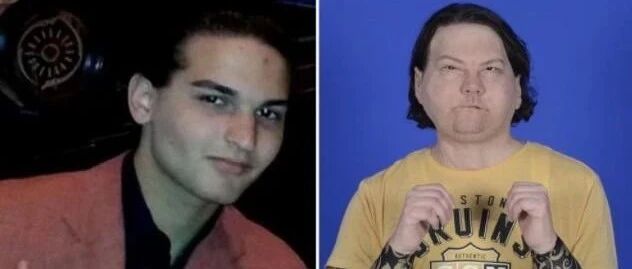 手术：双手和面部同时移植，Materialise的3D打印立功了