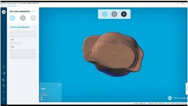 人體3D掃描一體化解決方案助力康復輔具數字化升級的圖4