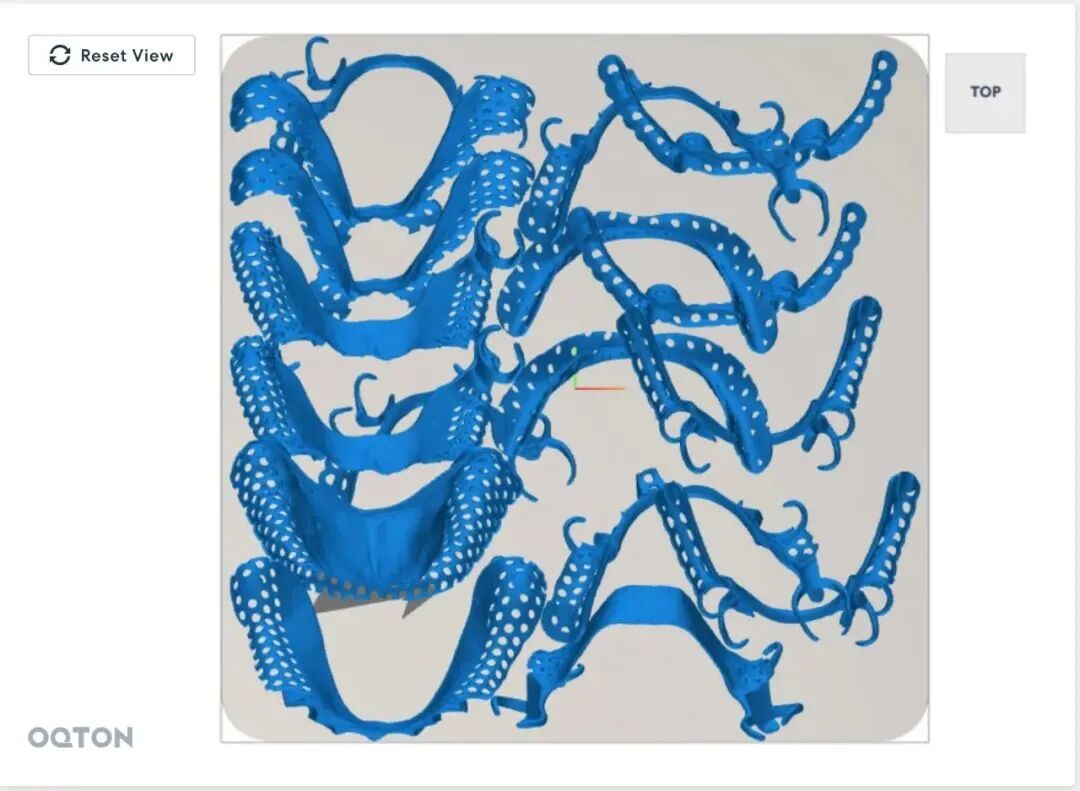 Oqton“0键” 24小时全自动3D打印产线排版，赋能数字化口腔正畸大生产的图6