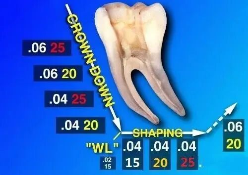 使用镍钛根管锉，如何避免断针？